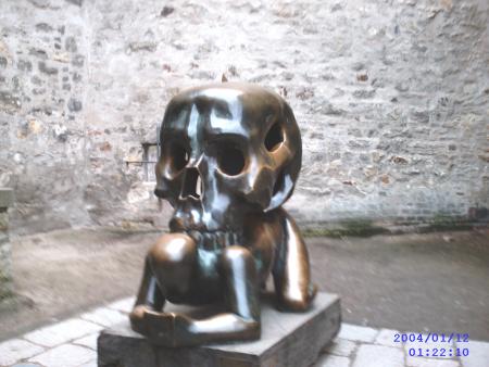 Sodoencéphalogramme
